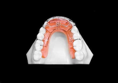 Standard Spring Retainer